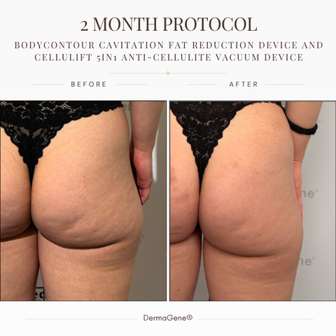 Total Body Sculpt & Smooth Ritual