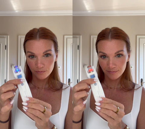 DermaGene® MicroLuxe 4-in-1 Mikronadel-Gerät mit LED & Mikrostrom